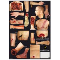 VERLETZUNGSMUSTER-SET, Teil 1